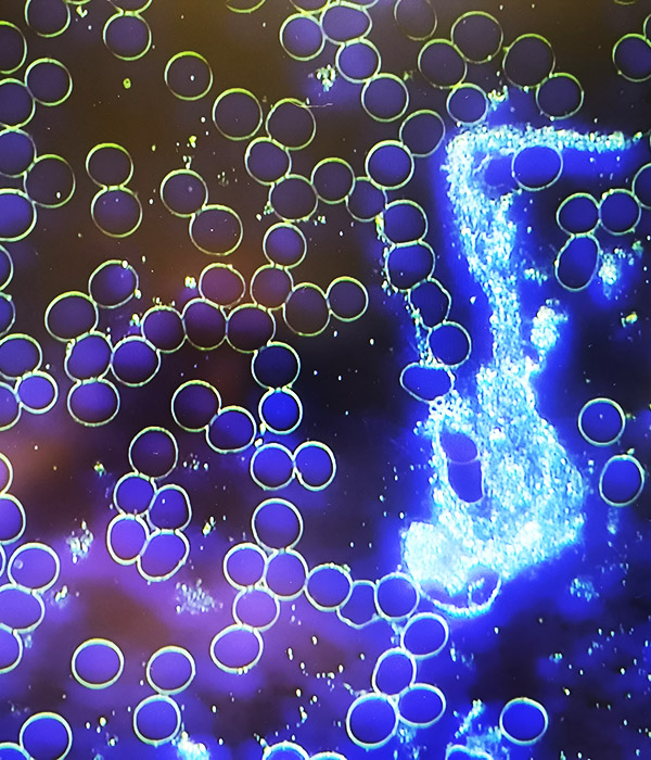 Vitalblutanalyse mit dem Dunkelfeldmikroskop bei der Entstöhrungspraxis in Wiener Neustadt